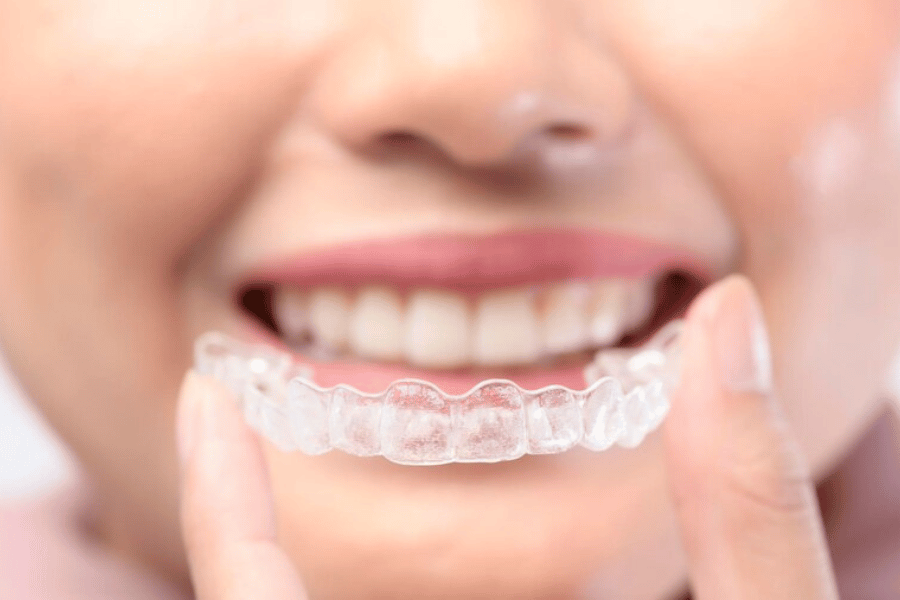 Invisalign Cost in Tennessee