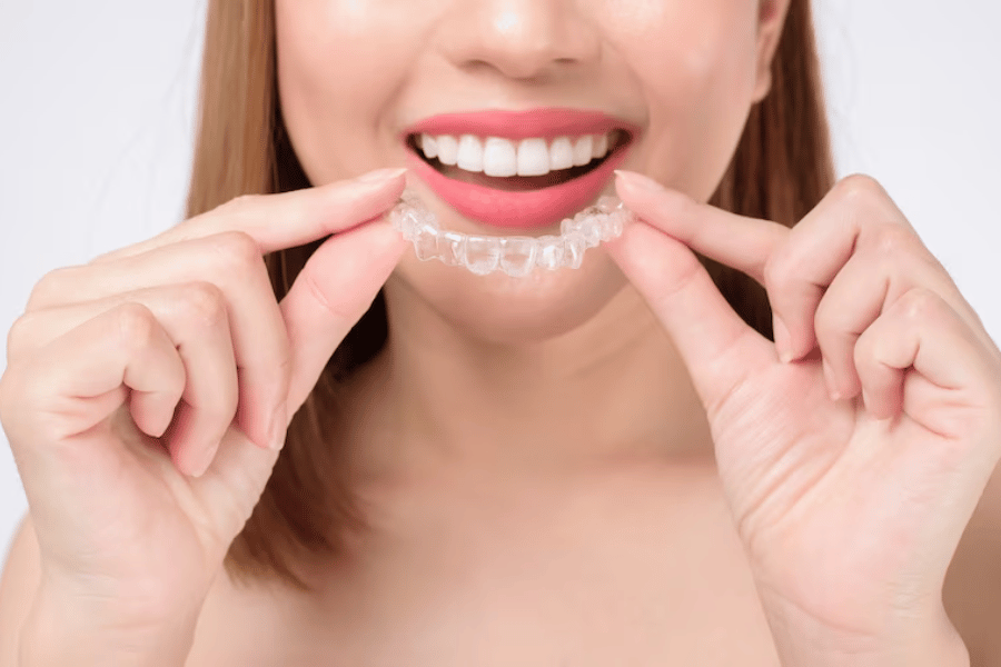 Invisalign cost in Oregon