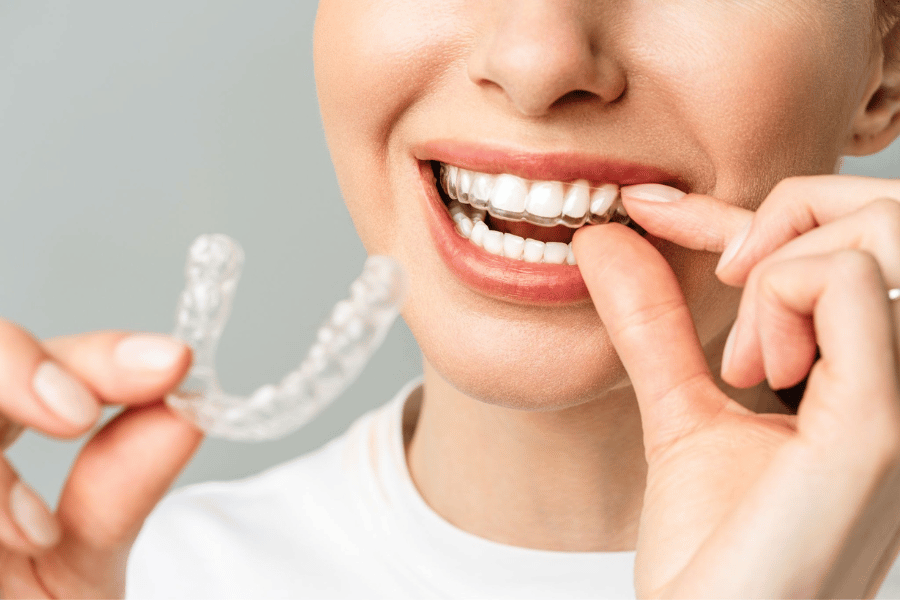 A woman is wearing her clear aligners