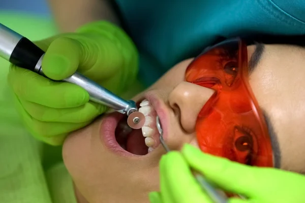 An image of a person undergoing treatment for chipped teeth