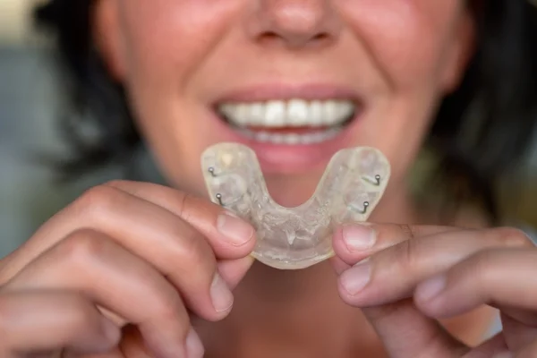 clear mouth guards